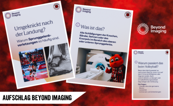 Aufschlag Beyond Imaging: Sprunggelenkverletzungen im Check