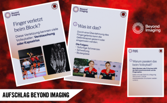 Aufschlag Beyond Imaging: Kapsel-Band-Verletzungen der Finger im Check