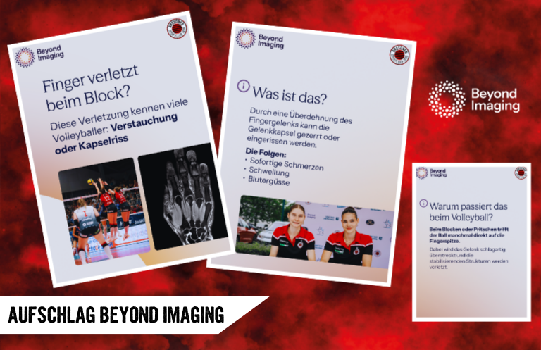 Aufschlag Beyond Imaging: Kapsel-Band-Verletzungen der Finger im Check