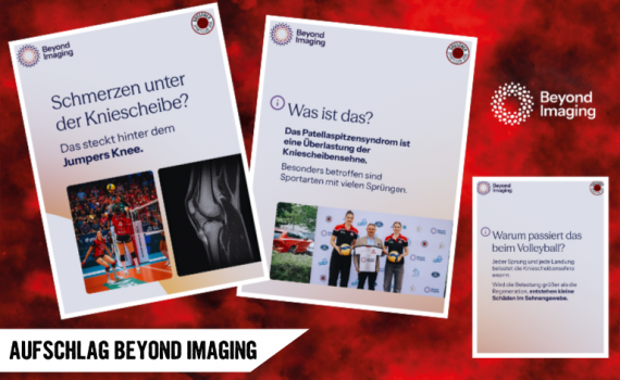 Aufschlag Beyond Imaging: Das „Jumper’s Knee“ im Check