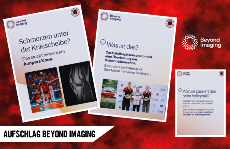 Aufschlag Beyond Imaging: Das „Jumper’s Knee“ im Check