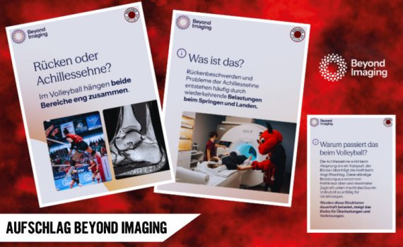 Aufschlag Beyond Imaging: Rücken und Achillessehne im Check