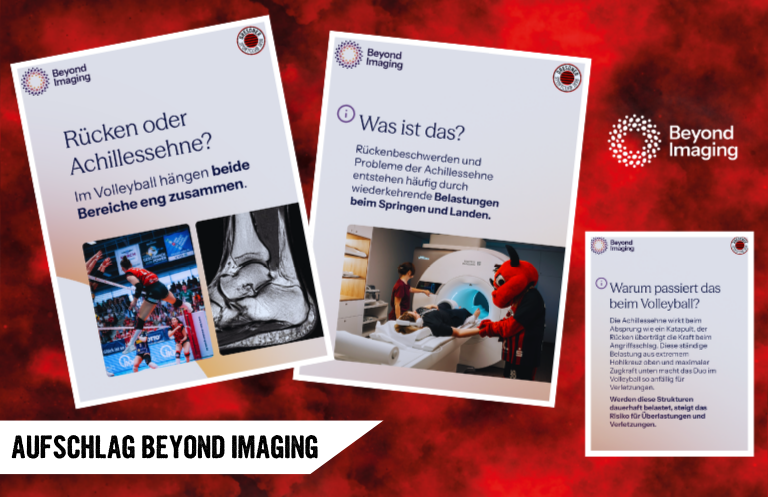 Aufschlag Beyond Imaging: Rücken und Achillessehne im Check